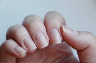 Восстановление ногтей после снятия
